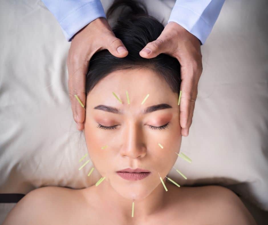 Women's Face with Acupuncture Needles